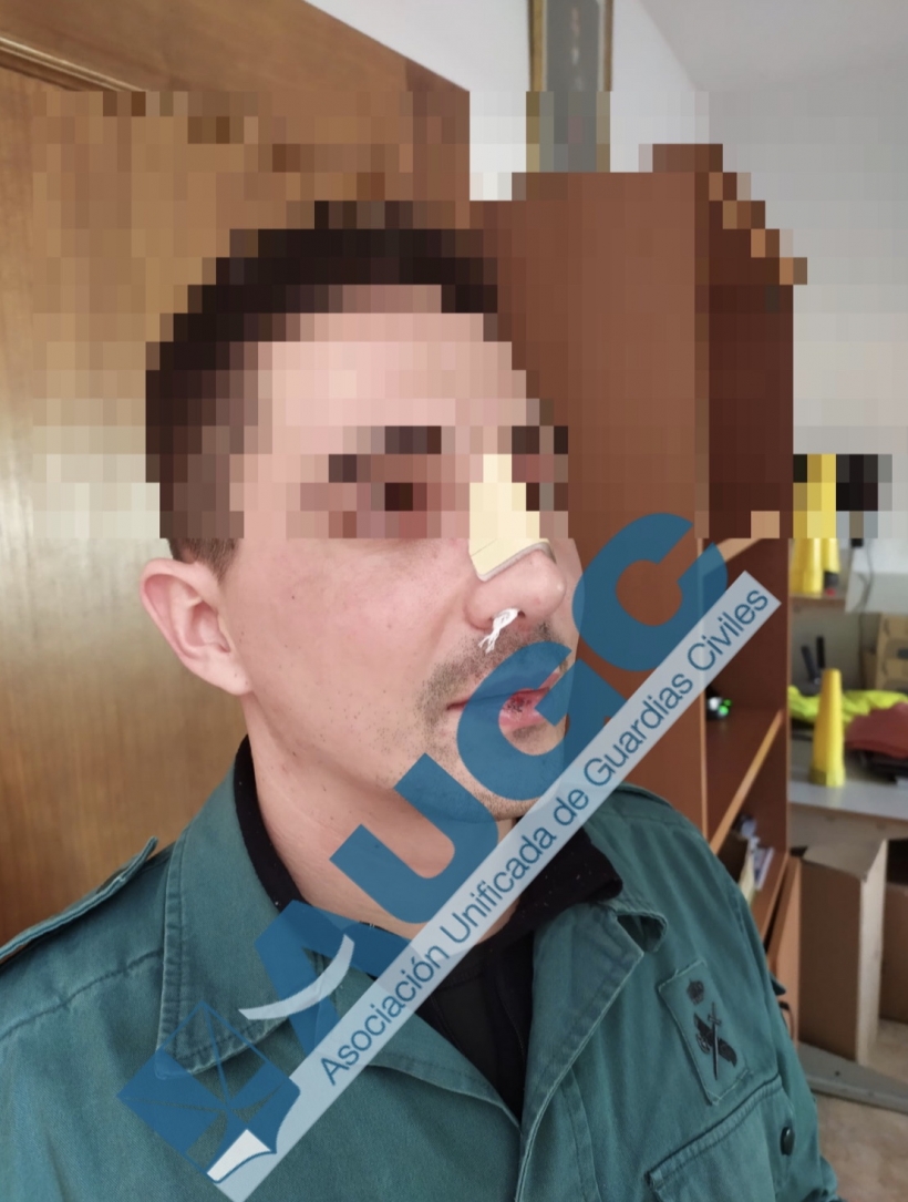 Las agresiones a los agentes de la autoridad deben castigarse con mayor ejemplaridad, para proteger a quienes velan por la seguridad. Las agresiones a los agentes de la autoridad deben castigarse con mayor ejemplaridad, para proteger a quienes velan por la seguridad.